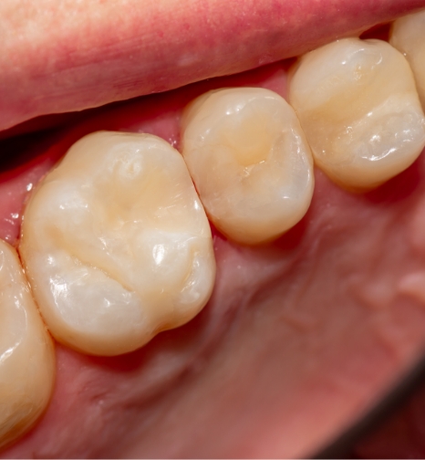 Close up of a row of teeth from childrens dentist in Hayward