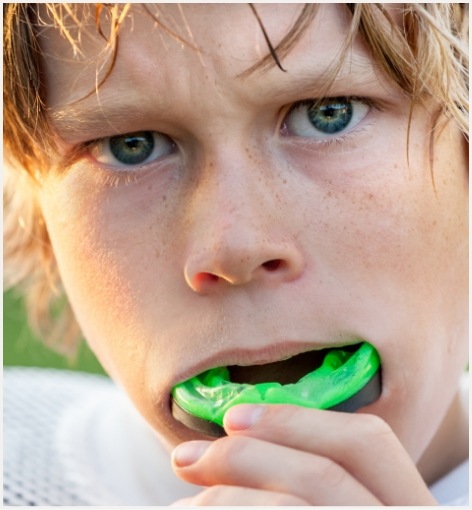 Young boy placing green mouthguard into his mouth