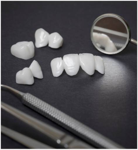 Several dental crowns and veneers on table