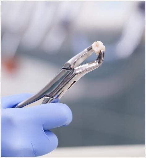 Dentist holding an extracted tooth in a pair of dental forceps