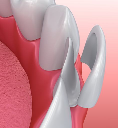 Dentist holding shade scale next to patient's smile